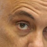 MORAES OLHO