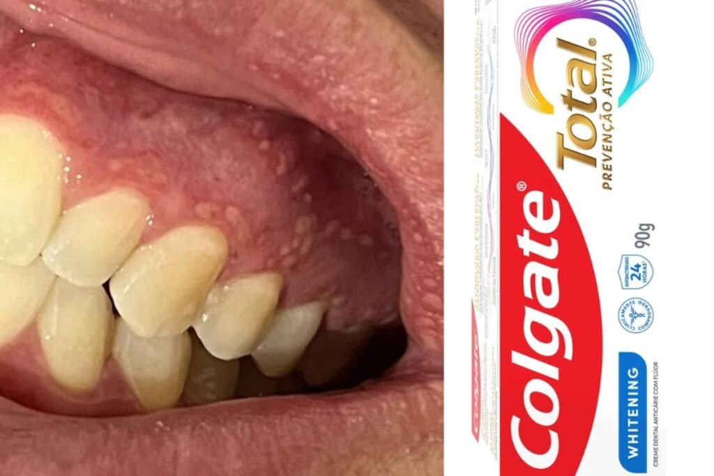 brasil-colgate-creme dental-fórmula-1742829879