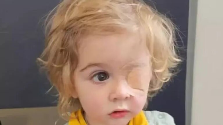 olho