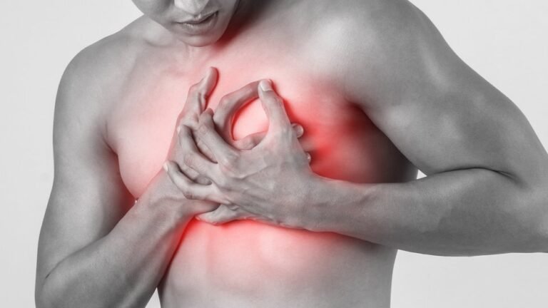 infarto