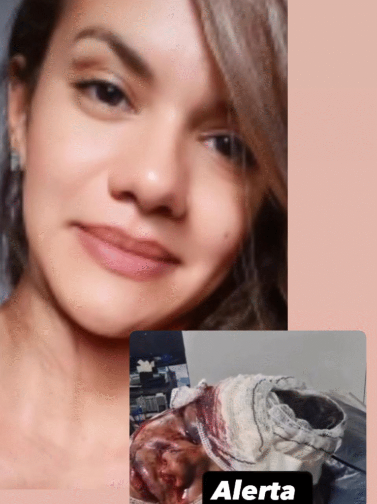image-344-766x1024 Vídeo: Espancada pelo namorado, Juliana tem rosto desfigurado e precisa de cirurgia