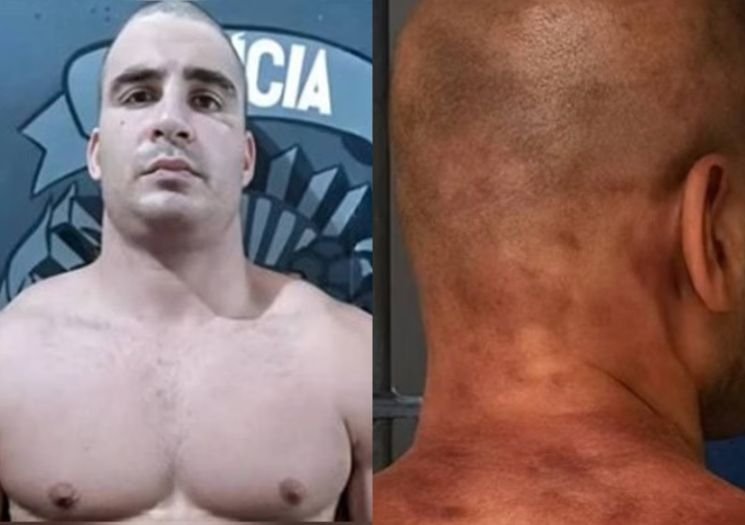 689340e9d9506-ex-jogador-e-agredido-na-prisao-apos-dar-61-socos-em-mulher