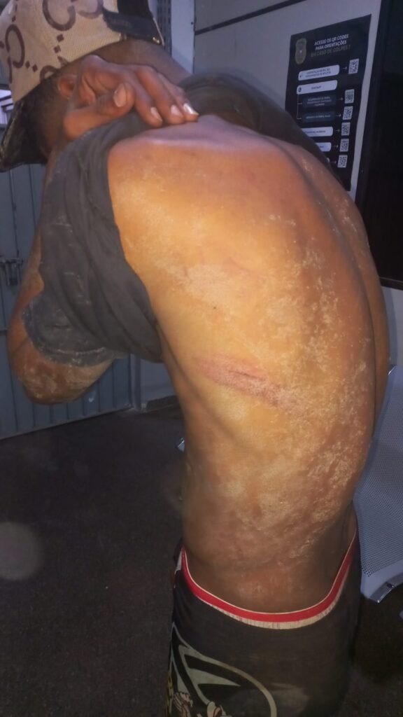 WhatsApp-Image-2025-08-08-at-02.07.27-576x1024 Tortura de facção deixa homem em estado grave em Cuiabá