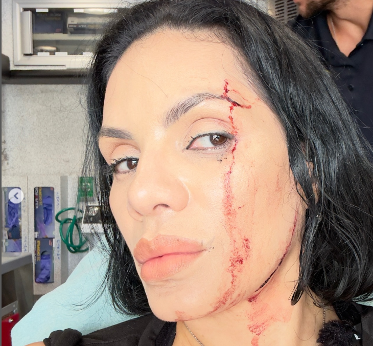image-466 Acidente chocante: SUV atinge casal durante gravação de vlog
