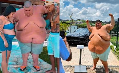 image-406 Influenciador Gordão da XJ perde 115 kg; veja antes e depois