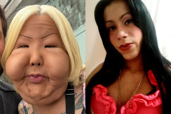 image-251 Influencer aplica óleo mineral no rosto em local clandestino; veja antes e depois