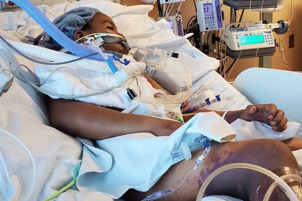 image-30-1024x683 Gripe evolui para septicemia e menino de 7 anos perde as duas pernas