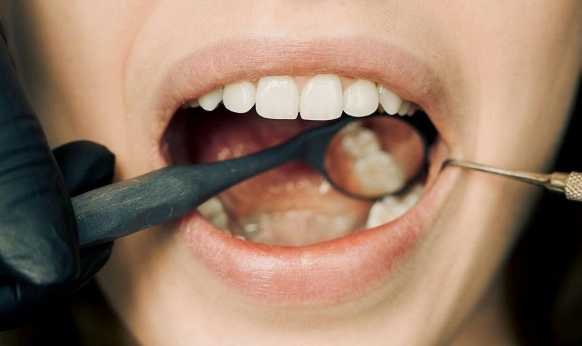 saude-bucal-e1767022912204